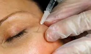 Procedimientos estéticos no regulados en Puerto Rico: riesgos, situación actual y el debate sobre nuevas regulaciones